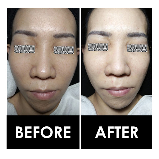 Bellezza Aesthetics Wheelock Place